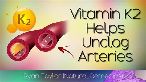 Vitamin K2 Helps keep the arteries clear of calcium and may even reverse calcium deposits already present in the arteries. . Vitamin k2 cleared my arteries
